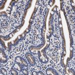 ACOX1 Antibody in Immunohistochemistry (Paraffin) (IHC (P))