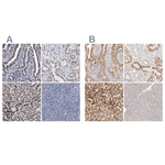 ACOX1 Antibody in Immunohistochemistry (Paraffin) (IHC (P))