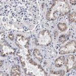 ACOX1 Antibody in Immunohistochemistry (Paraffin) (IHC (P))
