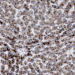 ACOX1 Antibody in Immunohistochemistry (Paraffin) (IHC (P))