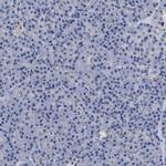 ACOX1 Antibody in Immunohistochemistry (Paraffin) (IHC (P))