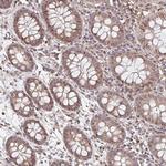 NYREN18 Polyclonal Antibody