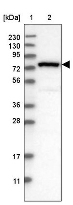 NYREN18 Antibody in Western Blot (WB)