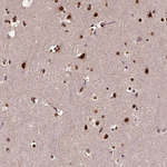 NAC1 Antibody in Immunohistochemistry (Paraffin) (IHC (P))
