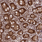 NAC1 Antibody in Immunohistochemistry (Paraffin) (IHC (P))