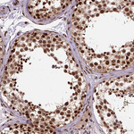 NAC1 Antibody in Immunohistochemistry (Paraffin) (IHC (P))