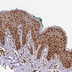 NAC1 Antibody in Immunohistochemistry (Paraffin) (IHC (P))