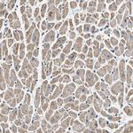 OXSM Antibody in Immunohistochemistry (Paraffin) (IHC (P))
