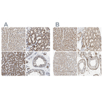 OXSM Antibody in Immunohistochemistry (Paraffin) (IHC (P))