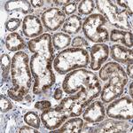 OXSM Antibody in Immunohistochemistry (Paraffin) (IHC (P))