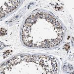 OXSM Antibody in Immunohistochemistry (Paraffin) (IHC (P))
