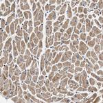 OXSM Antibody in Immunohistochemistry (Paraffin) (IHC (P))