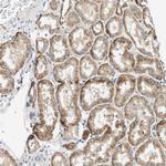 OXSM Antibody in Immunohistochemistry (Paraffin) (IHC (P))