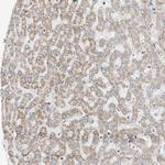 OXSM Antibody in Immunohistochemistry (Paraffin) (IHC (P))