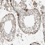 OXSM Antibody in Immunohistochemistry (Paraffin) (IHC (P))