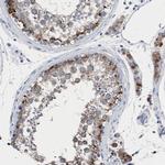 HSD17B4 Antibody in Immunohistochemistry (Paraffin) (IHC (P))