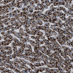 HSD17B4 Antibody in Immunohistochemistry (Paraffin) (IHC (P))