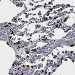 HSD17B4 Antibody in Immunohistochemistry (Paraffin) (IHC (P))