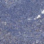 HSD17B4 Antibody in Immunohistochemistry (Paraffin) (IHC (P))