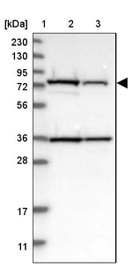 HSD17B4 Antibody in Western Blot (WB)