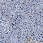 RGS10 Polyclonal Antibody