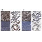 HSD17B4 Antibody in Immunohistochemistry (Paraffin) (IHC (P))