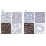 Carboxypeptidase A2 Polyclonal Antibody
