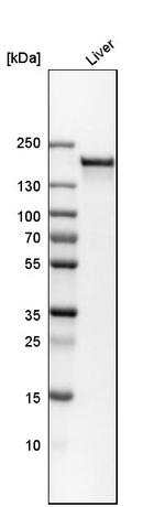 CPS1 Antibody in Western Blot (WB)