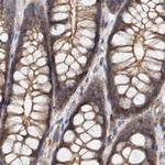 NSP5 Antibody in Immunohistochemistry (Paraffin) (IHC (P))