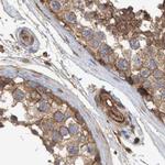 NSP5 Antibody in Immunohistochemistry (Paraffin) (IHC (P))