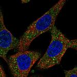 NPEPPS Polyclonal Antibody
