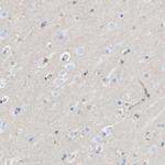 PRKD2 Polyclonal Antibody
