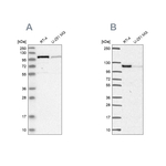 PRKD2 Antibody in Western Blot (WB)