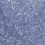 Jagged1 Polyclonal Antibody