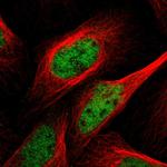 POLR2A Polyclonal Antibody