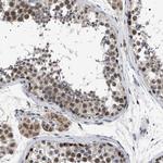 POLR2A Antibody in Immunohistochemistry (Paraffin) (IHC (P))
