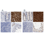 CTH Polyclonal Antibody