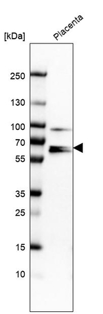 Ezrin Antibody in Western Blot (WB)