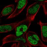 ECM29 Polyclonal Antibody