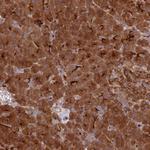 ECM29 Antibody in Immunohistochemistry (Paraffin) (IHC (P))