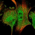 RACK1 Polyclonal Antibody