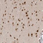 CAF1 p60 Antibody in Immunohistochemistry (Paraffin) (IHC (P))