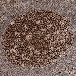 CAF1 p60 Antibody in Immunohistochemistry (Paraffin) (IHC (P))