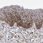 CAF1 p60 Antibody in Immunohistochemistry (Paraffin) (IHC (P))