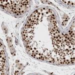 CAF1 p60 Antibody in Immunohistochemistry (Paraffin) (IHC (P))