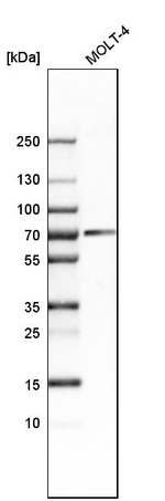 CAF1 p60 Antibody in Western Blot (WB)