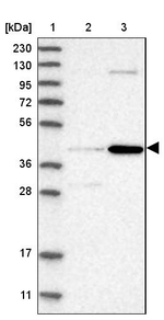 CHRDL2 Antibody in Western Blot (WB)