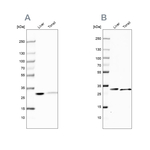 Carbonic Anhydrase III Antibody in Western Blot (WB)