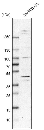 MKNK2 Antibody in Western Blot (WB)