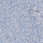 CD301 Antibody in Immunohistochemistry (Paraffin) (IHC (P))
